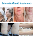 Rejuva 360 Ultra Formation Professional HIFU Machine for Body & Face