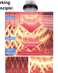 Working principles of 40k ultrasound of lipo cavitation Machine
