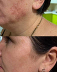 DuoSmooth 2-in-1 Diode Laser + IPL System