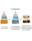 Diamond Ice Cryo EMShape® Mini