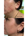 DuoSmooth™ 2-in-1 Diode Laser + IPL System