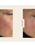 DuoSmooth™ 2-in-1 Diode Laser + IPL System