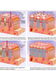 CoolPare EXPERT Fractional CO2 Laser