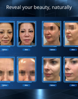 Perfect Face Neo-X Face Lift Machine