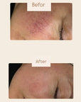 DuoSmooth 2-in-1 Diode Laser + IPL System