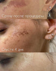DuoSmooth 2-in-1 Diode Laser + IPL System