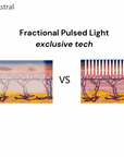 APEX™ 10D Professional Intense Pulsed Light System