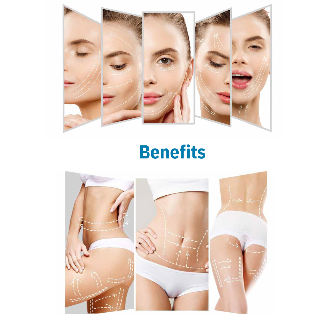 360 Ultra Formation Professional HIFU Machine for Body &amp; Face