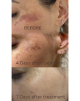 DuoSmooth™ 2-in-1 Diode Laser + IPL System