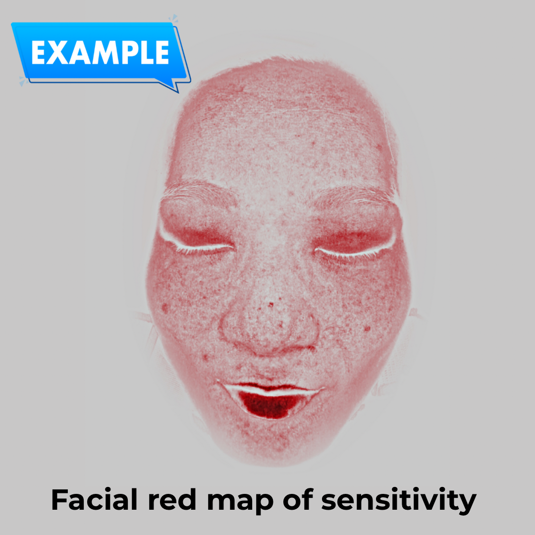 Imagica™ Skin Analyzer &amp; Sharing System