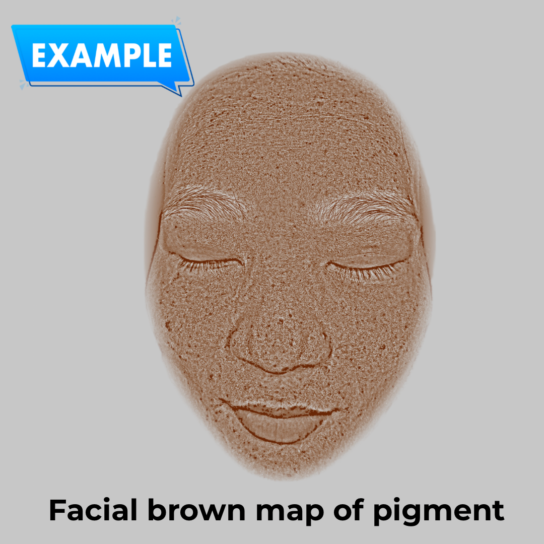 Imagica™ Skin Analyzer &amp; Sharing System
