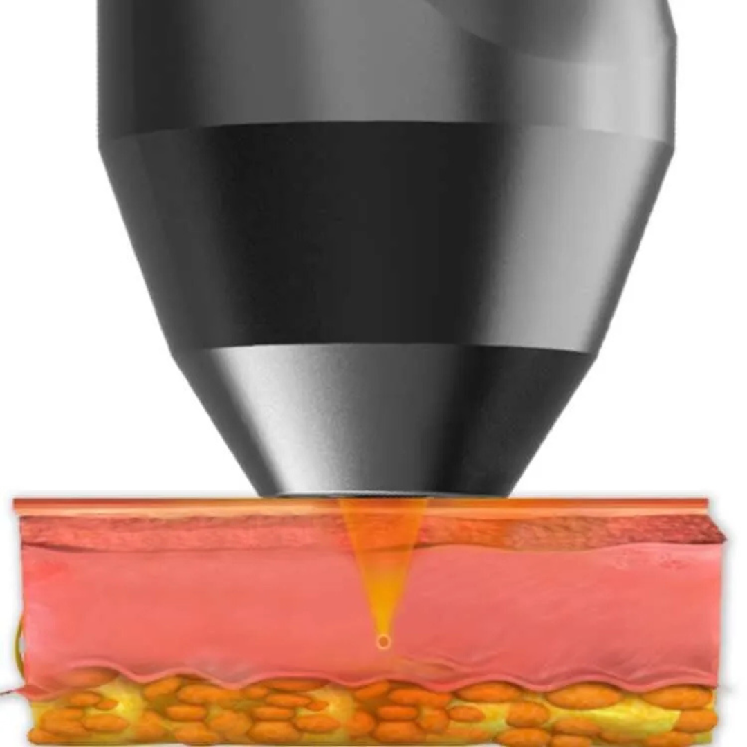 LuminaTight™ 10D HIFU Machine Professional
