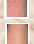 DuoSmooth™ 2-in-1 Diode Laser + IPL System