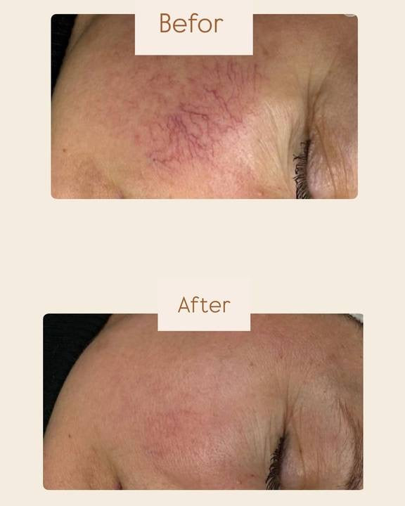 DuoSmooth 2-in-1 Diode Laser + IPL System